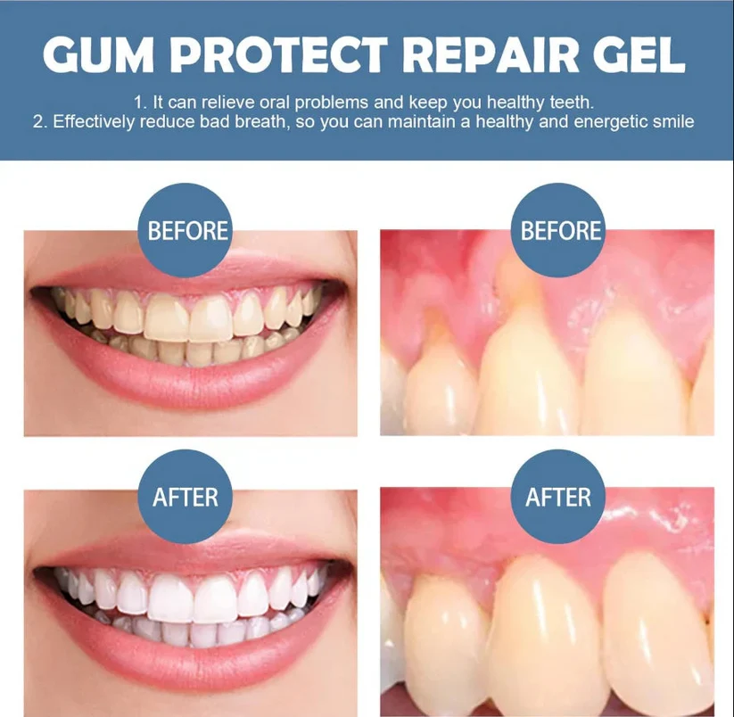 Frosume™ Teeth Repair Gel
