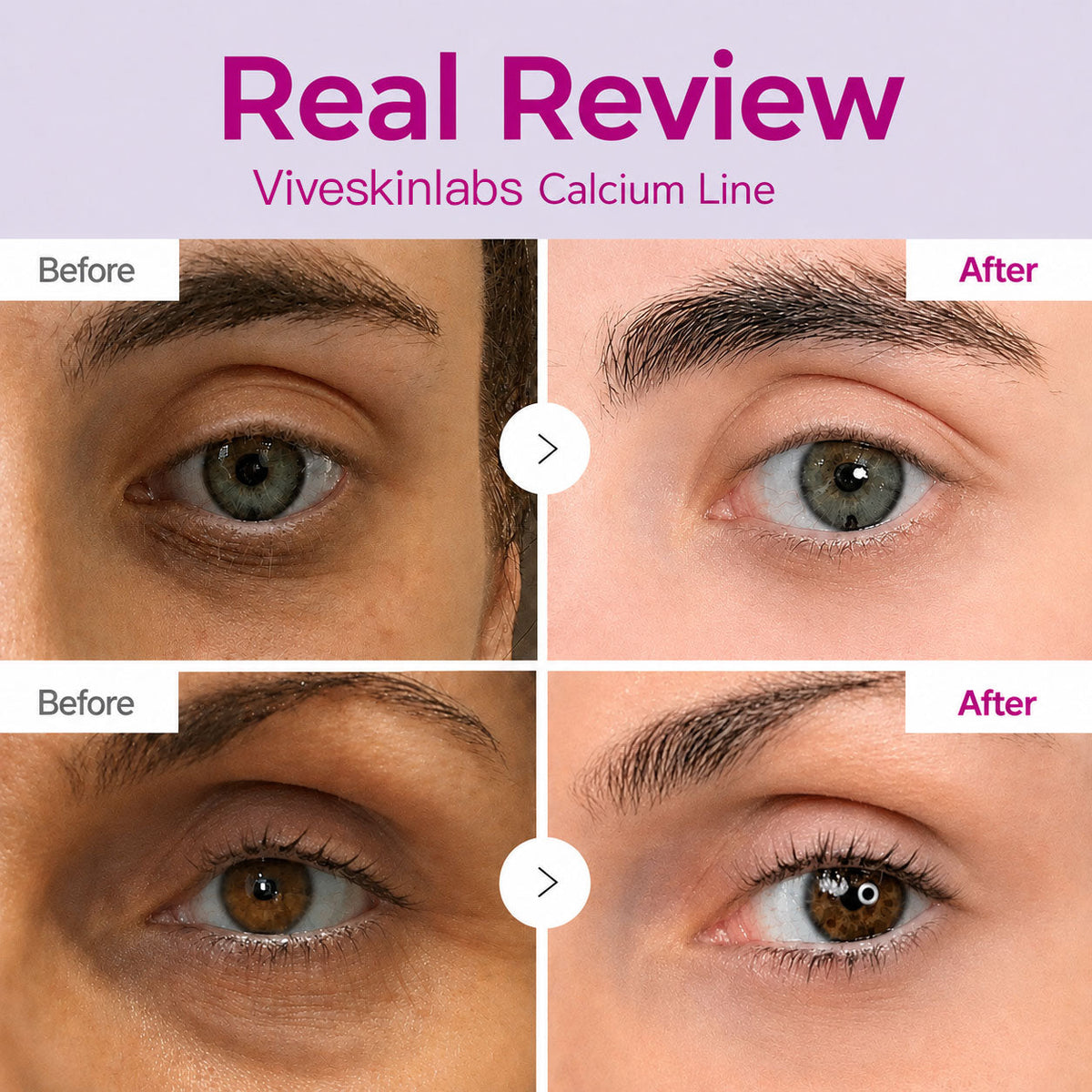 🔥LAST DAY 50% OFF!!Slimifyvibe Korean Calcium Dark Spot Eye Cream