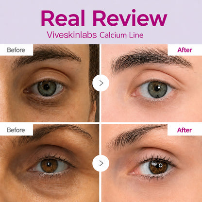 🔥LAST DAY 50% OFF!!Slimifyvibe Korean Calcium Dark Spot Eye Cream