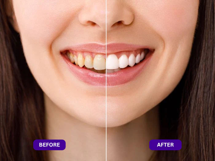 Frosume™ Purple Mouth Wash