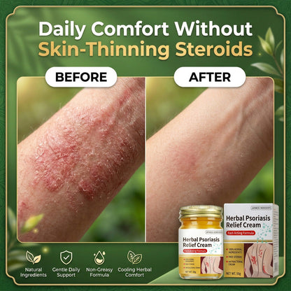 Herbal Psoriasis & Eczema Relief Skin Cream