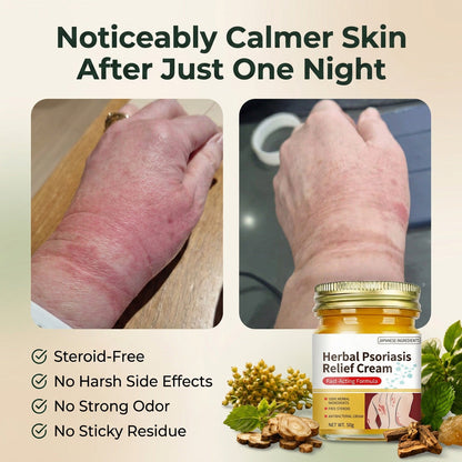 Herbal Psoriasis & Eczema Relief Skin Cream