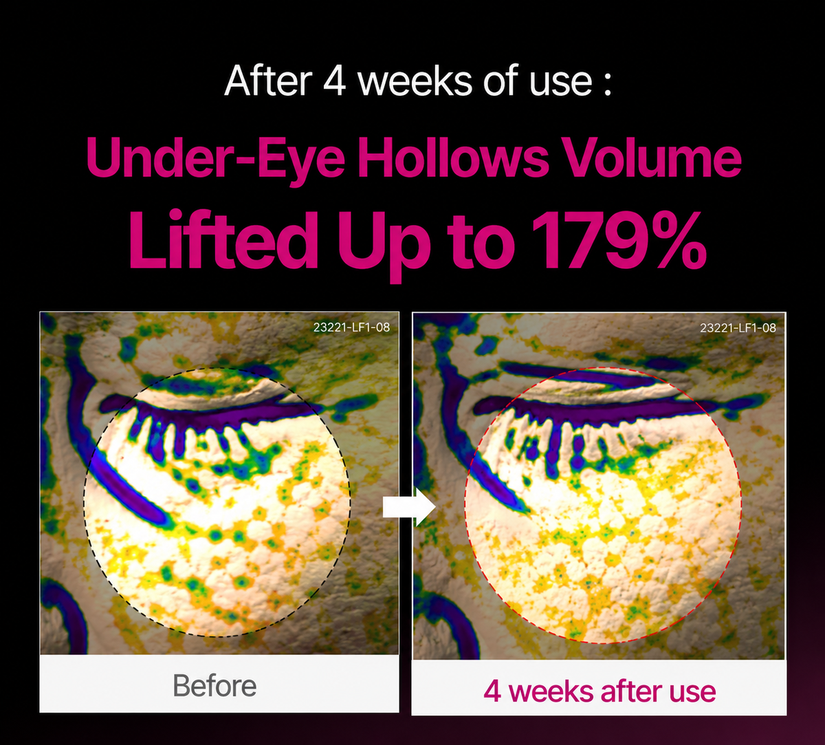 🔥LAST DAY 50% OFF!!Slimifyvibe Korean Calcium Dark Spot Eye Cream